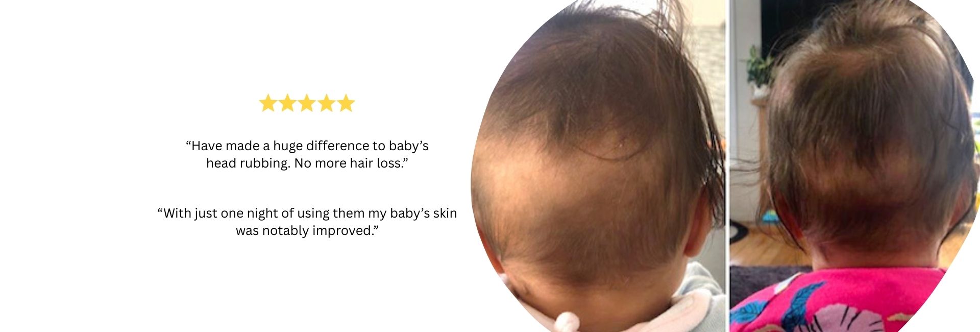 before and after baby bald spots after sleeping on Silk cot sheets by Monday Silks